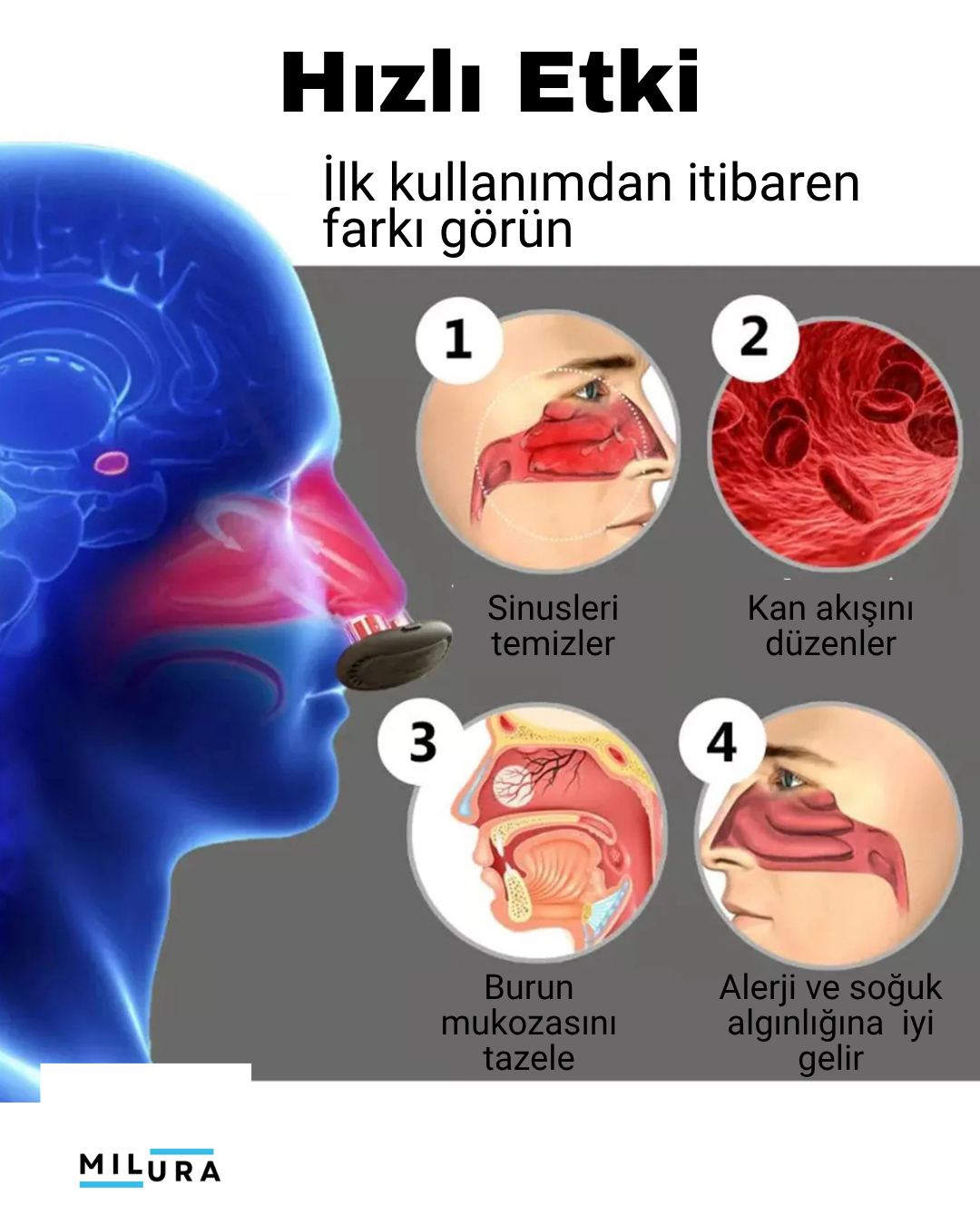 Milura Oxynose